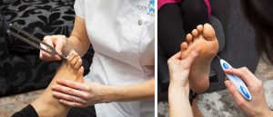 Diabetic Foot Assessment at FootSmart Podiatry- checking for diabetic neuropathy using a tuning fork & monofilament